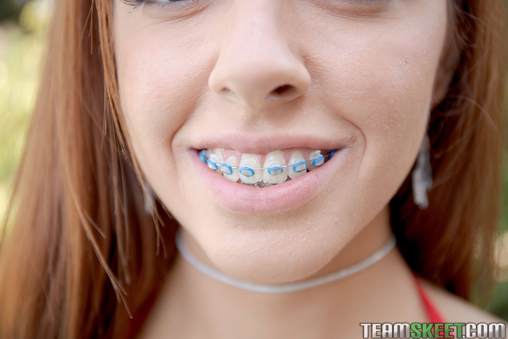 Oral Orthodontics