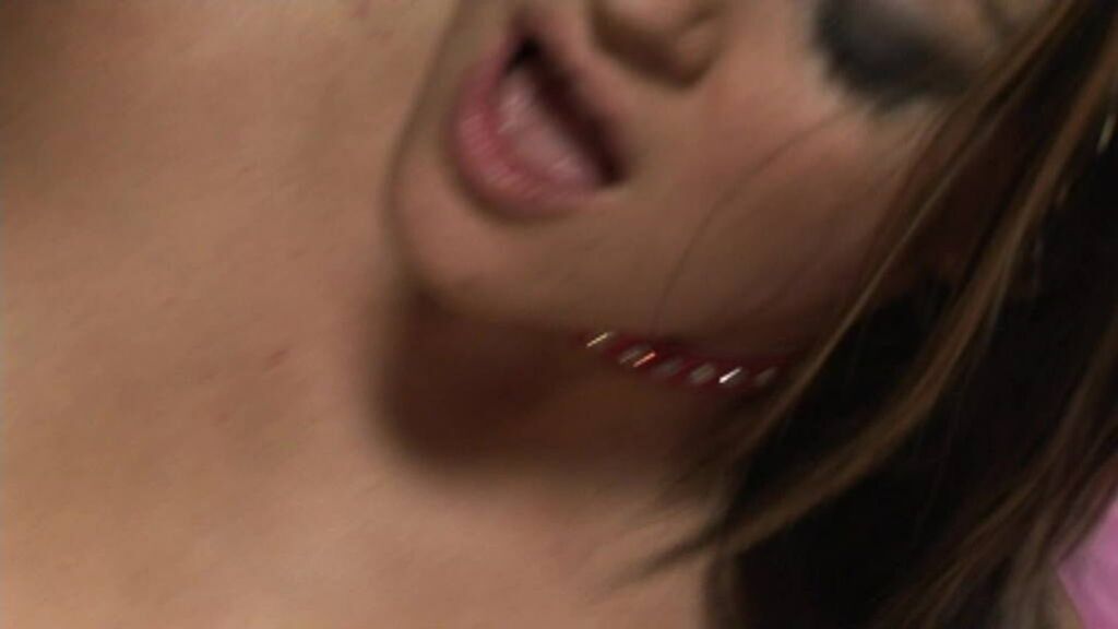 Anal HDV127