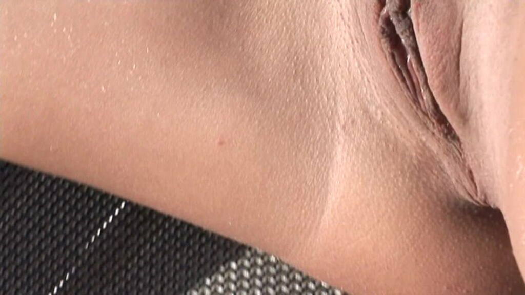 Anal HDV127
