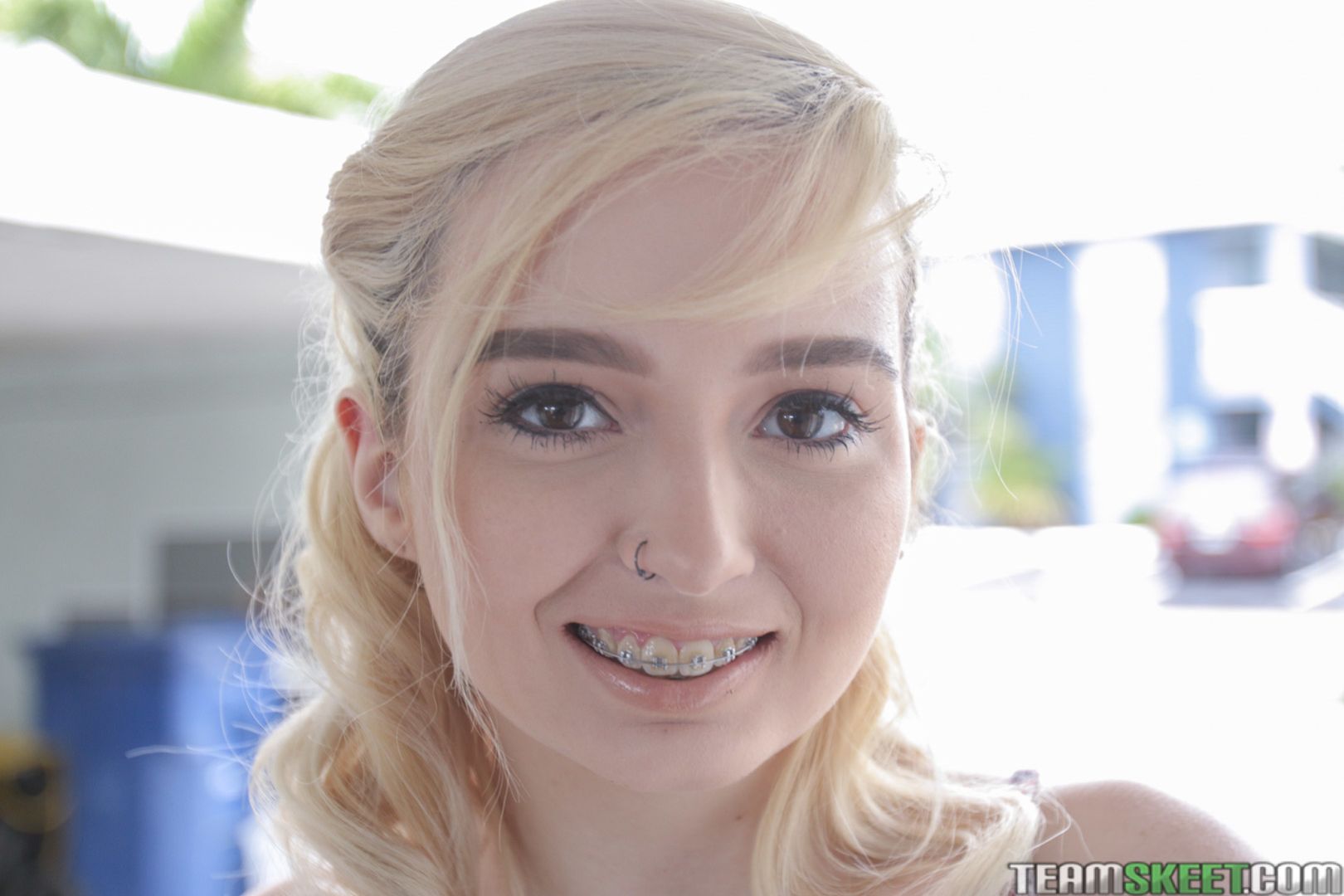 The Bracefaced Hook Up