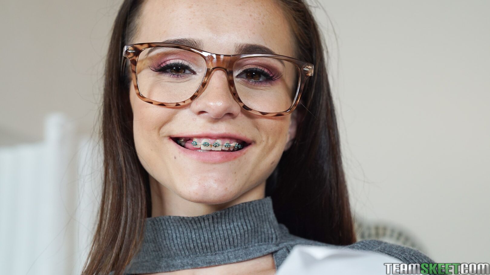 College Guys Love Braces