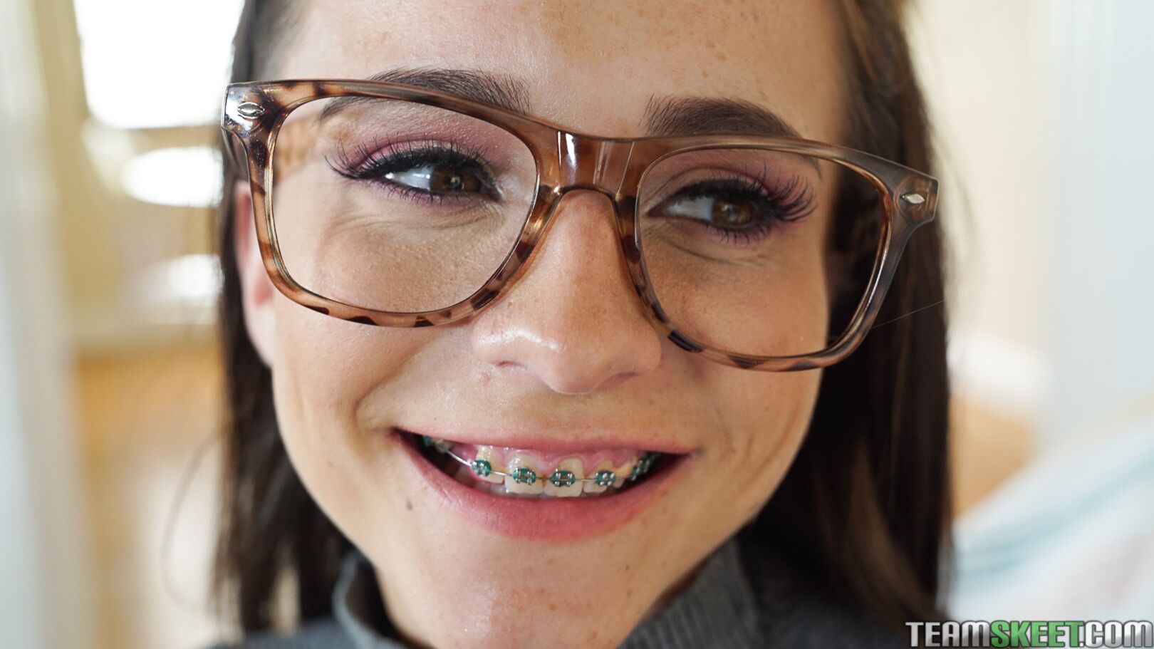 College Guys Love Braces