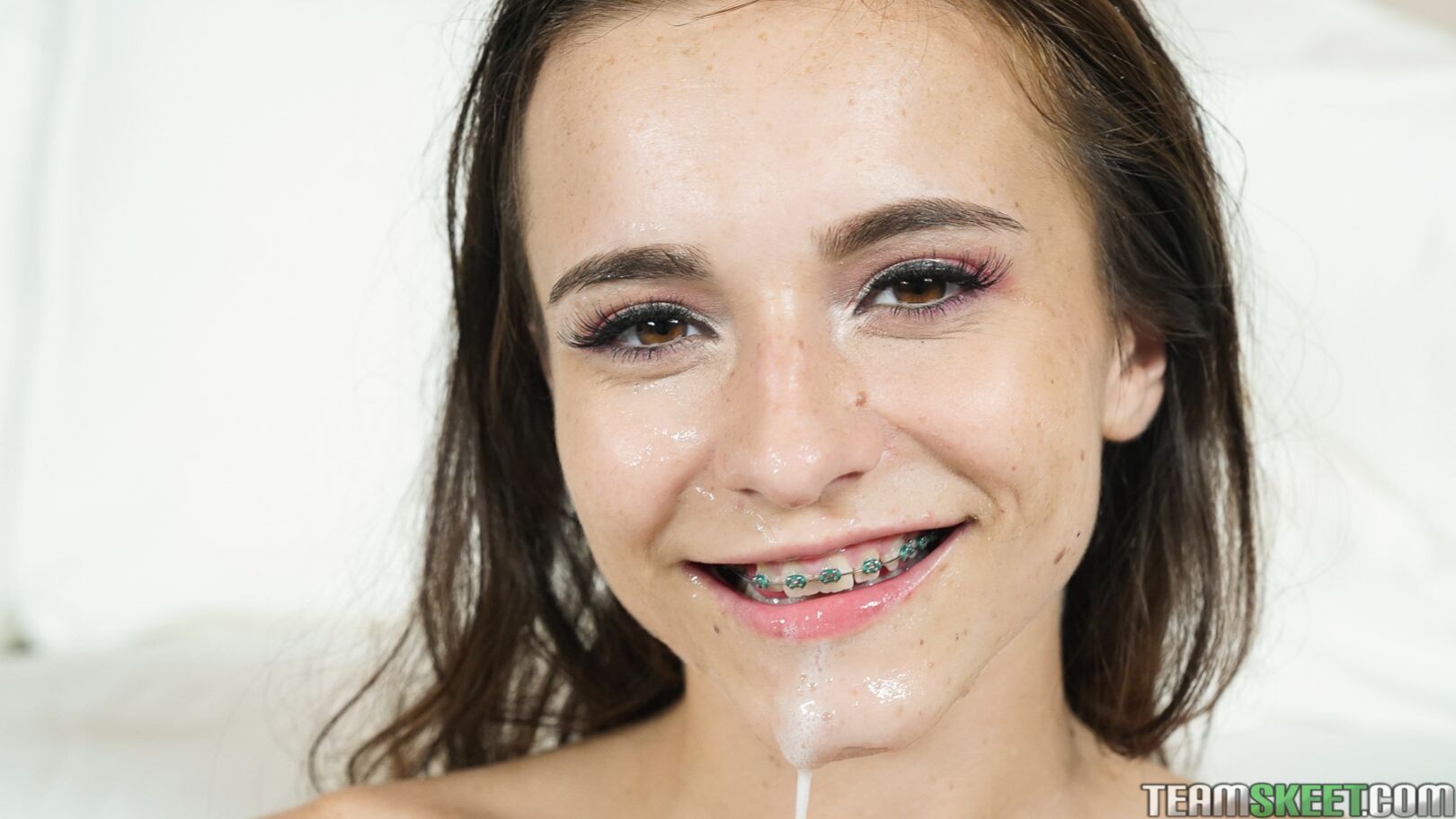 College Guys Love Braces
