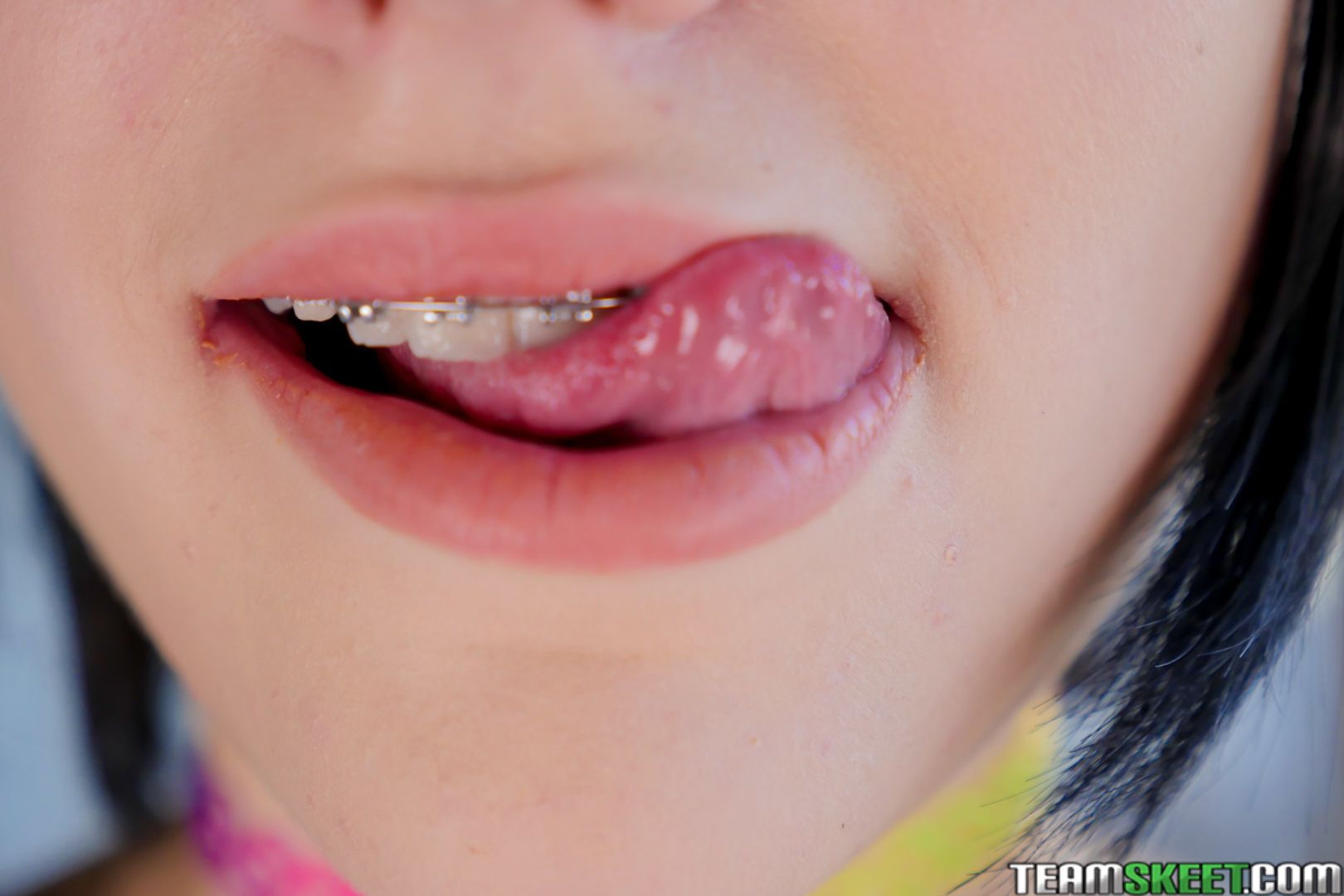 The Original Brace Face
